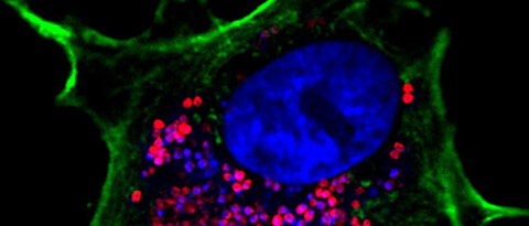 Staphylococcus aureus (rot) wird effizient in menschliche Zellen (im Bild eine Lungenepithelzelle, grün) aufgenommen. Blau dargestellt sind Zellkern und Bakterien-DNA. Maßstab 0,005 Millimeter. (Bild: Martin Fraunholz)