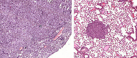 A lung tumor that expresses USP28 (left). On the right, however, tumors are shown in which USP28 has been "cut out" using the gene editing tool CRISPR/Cas9 – they are significantly smaller. The size bar is located on the left edge of the picture.