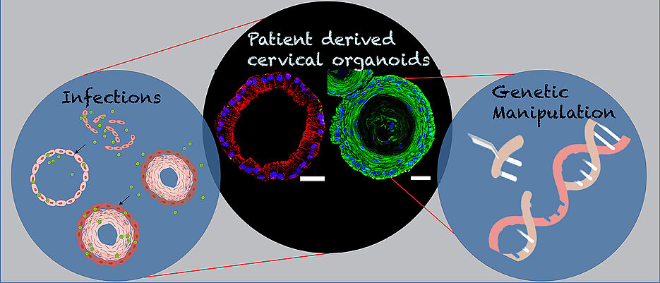 Image of patient-derived endocervical columnar (red) ectocervical stratified squamous organoids (Green) of female reproductive tract, and diagram depicting their genetic manipulation and infections. 