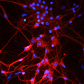 Nervenzellen der Maus
