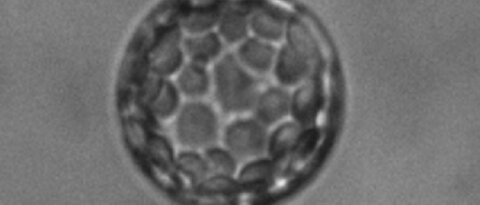 Zelle aus einem Blatt der Ackerschmalwand (Arabidopsis thaliana), befreit von ihrer Zellwand (A). Wird auch noch die Zellmembran entfernt, bleibt die große Vakuole übrig (B), die dann für Pumpstrommessungen mit der Patch-Clamp-Technik zugänglich ist. 