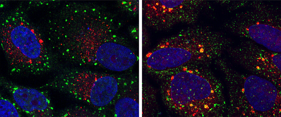 Microscopic colour image showing cells with normal (green dots) and abnormal (yellow dots) stress granules. (Photo: Buchberger team)