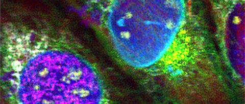 Unique: Nine different cell structures were fluorescence labelled at once to become distinguishable under the microscope.