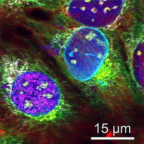 Unique: Nine different cell structures were fluorescence labelled at once to become distinguishable under the microscope.