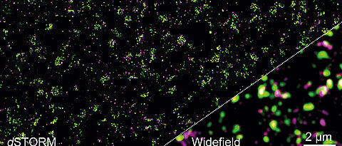 Die Verteilung des Glutamat-Rezeptors mGluR4 und anderer Proteine in der präsynaptischen Membran. Links ein hochaufgelöstes dSTORM-Bild. Rechts das Ergebnis, das mit konventioneller Fluoreszenzmikroskopie zu erreichen ist – molekulare Details sind hier nicht zu erkennen.