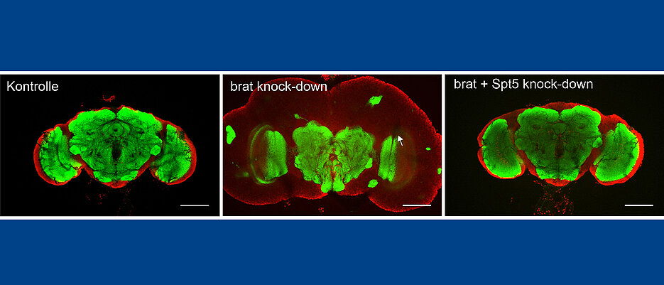 Brains of three-day-old adult flies. Left: Healthy specimens. Center: animals with a brain tumor. Right: Brain tumor after reduction of SPT5 levels. Green coloring shows central brain regions. Red coloring shows the cerebral cortex, which is strongly expanded by the tumor.