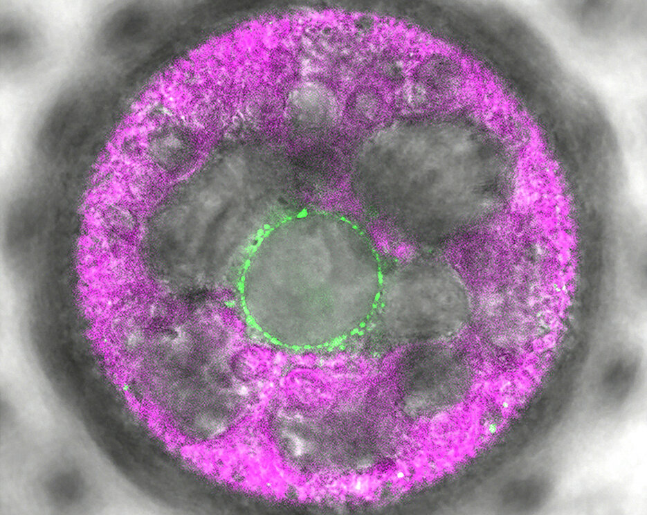 In this multicellular Volvox alga, the novel light sensor 2c-cyclop was labeled with fluorescence (green). It shows up in membranes around the nucleus. (Image: Eva Laura von der Heyde)