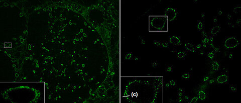 Sphingolipid expansion microscopy (ExM) of tenfold expanded cells infected with chlamydia. The bacterial membranes are marked green; the inner and outer membranes of the bacteria can be distinguished (c). Under (a) confocal laser scanning and under (b) structured illumination microscopy (SIM). Scale bars: 10 and 2 microns in the small white rectangles respectively.