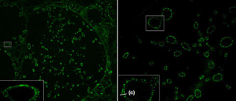 Sphingolipid-Expansionsmikroskopie (ExM) von zehnfach expandierten Zellen, die mit Chlamydien infiziert wurden. Grün markiert sind die Bakterienmembranen; die innere und die äußere Membran der Bakterien lassen sich unterscheiden (c). Unter (a) konfokales Laser-Scanning und unter (b) Strukturierte Beleuchtungsmikroskopie (SIM). Maßstabsbalken: 10 bzw. 2 Mikrometer in den kleinen weißen Rechtecken.