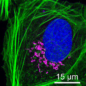 The sFLIM procedure enables utilising even the smallest differences in the dyes' fluorescence characteristics to identify them unambiguously.