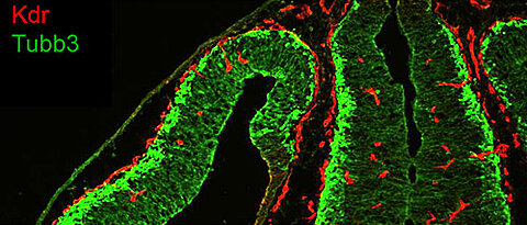 Verteilung von Endothelzellen und neuronalen Zellen im Gehirn der erwachsenen Maus. (Foto: AG Gessler)