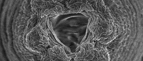 Kopfstrukturen des Fadenwurms C. elegans. Rasterelektronenmikroskopische Aufnahme; 6000-fache Vergrößerung).