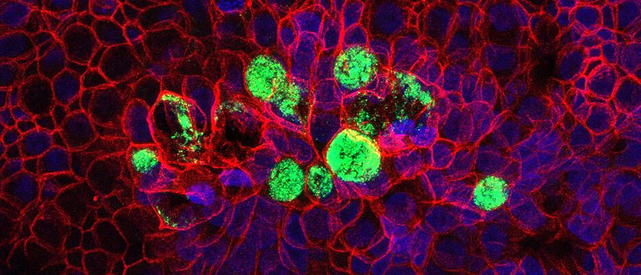 Mit Hilfe von Gewebemodelle lassen sich die angeborene sowie die erworbene Immunität erforschen. Hier zu sehen ist ein mit Bakterien (grün) infiziertes Gewebemodell von humanen Eileiterzellen.
