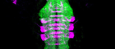 Abbildung des Gehirns einer Taufliegenlarve