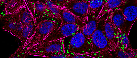 This fluorescence microscopy image shows Campylobacter jejuni bacteria (green) that have infected human cells (HeLa). The nuclei of host cells are stained in blue and the cytoskeleton (actin) in magenta, respectively.