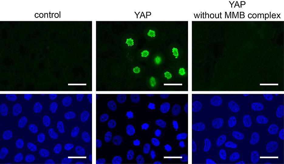 Cells divide after activation of YAP (green staining) – but only if the MMB protein complex is intact. Image: AG Gaubatz