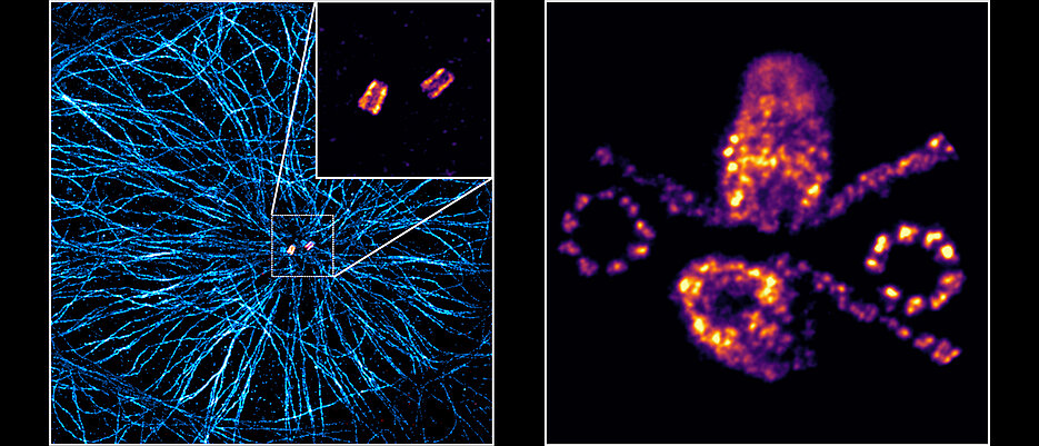 Microscopy of centrioles.