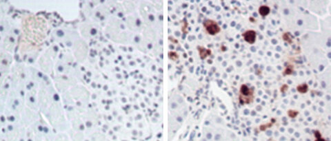 Zuviel Myc erzeugt Stress in Tumorzellen. Die Bilder zeigen Zellen des Pankreas. Links sind Kontrollen gezeigt, rechts Myc-exprimierende Zellen. Eine rote Färbung zeigt zellulären Stress an. (Bild: Daniel Murphy)