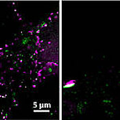 Synapses of brain cells: Here, the pre-synapses are tagged conventionally with antibodies (red); the post-synapses are labelled with special peptides which clearly enhances resolution.