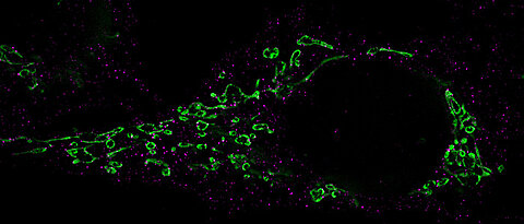 Microscopy showing the fragmentation of mitochondria