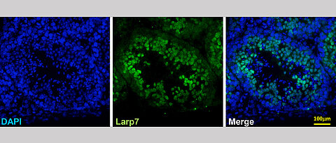 LARP7-Expression in der Keimbahn von Mäusen. Gezeigt ist eine Immunfärbung des Proteins (grün), die Zellkerne sind mit einem Farbstoff (DAPI) blau markiert.