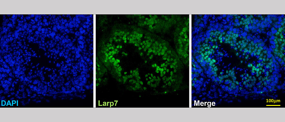 LARP7-Expression in der Keimbahn von Mäusen. Gezeigt ist eine Immunfärbung des Proteins (grün), die Zellkerne sind mit einem Farbstoff (DAPI) blau markiert.