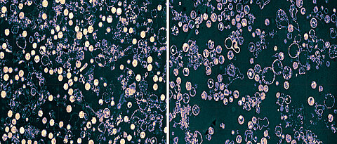 Links ruhende Chlamydien (helle Kreise), die ohne Glutamin gehalten werden. Nach der Zugabe von Glutamin (rechts) gehen die Bakterien in die Teilungsstadien über (dunklere Kreise).
